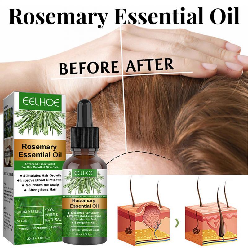 Rosemary Hair Growth Enhancer
