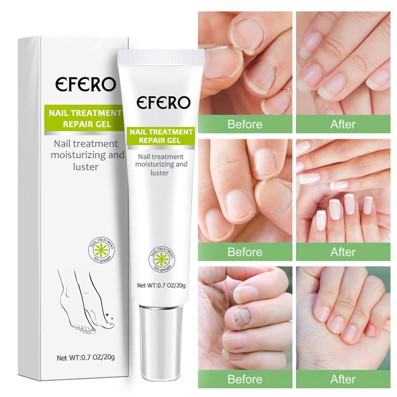 Nail Growth Enhancer