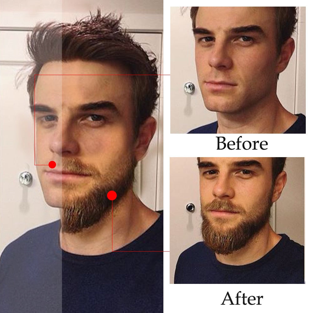 Beard Growth Enhancer